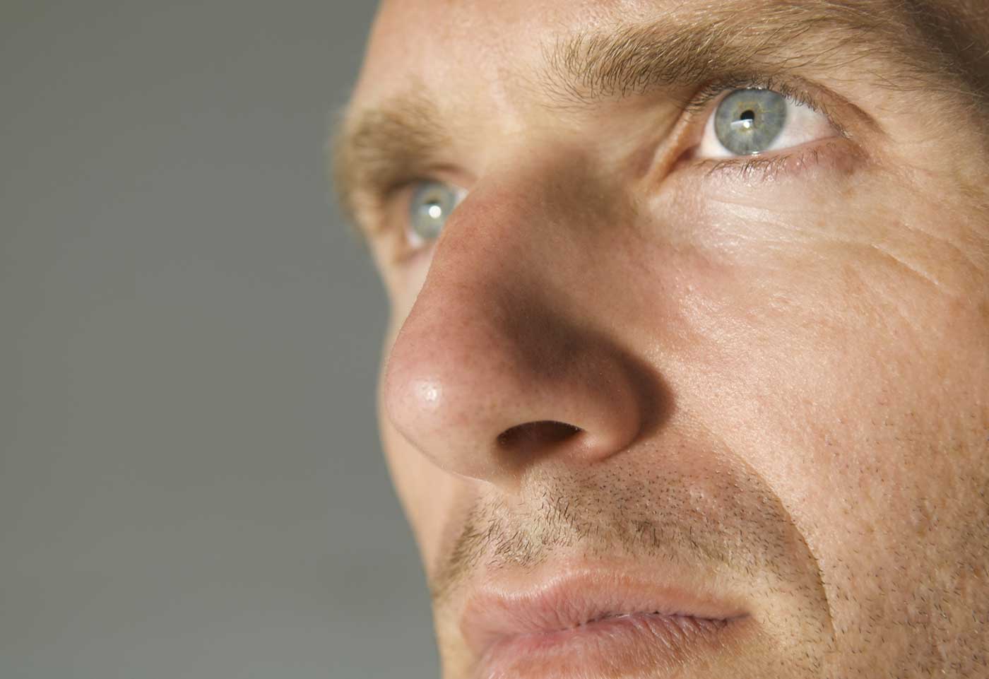 RHINOPLASTIE