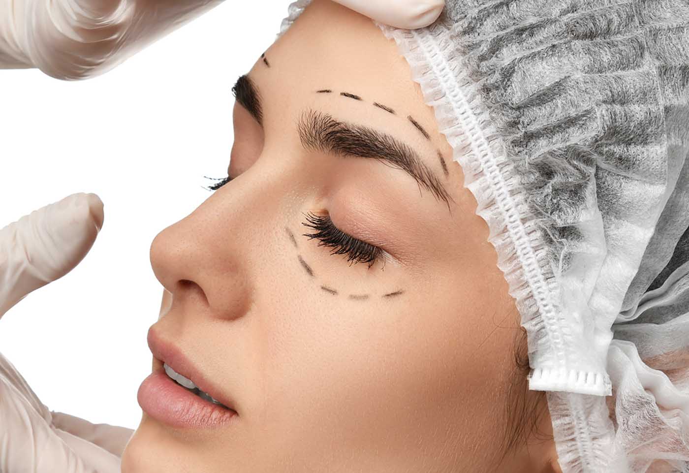 chirurgie des paupières