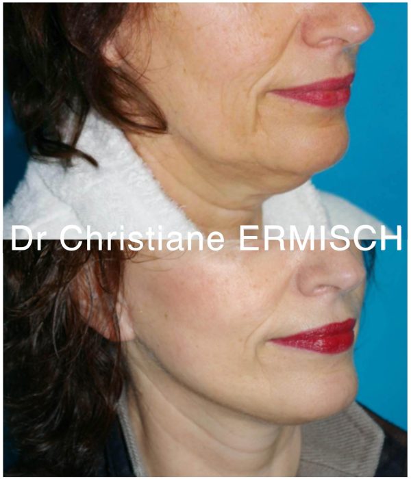 chirurgie visage et cou 2 chirurgie visage et cou 2