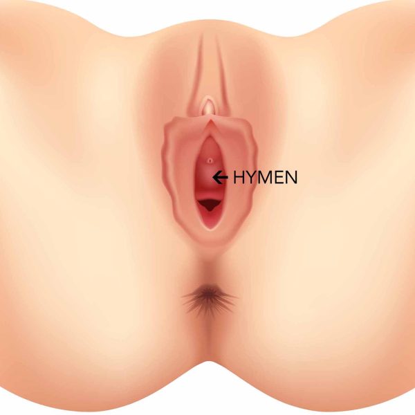 hymen reconstruction
