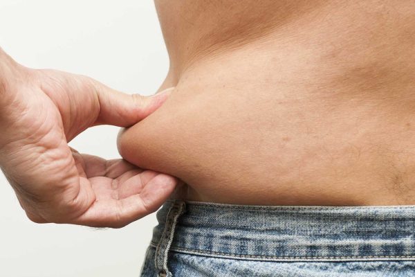 liposuccion homme